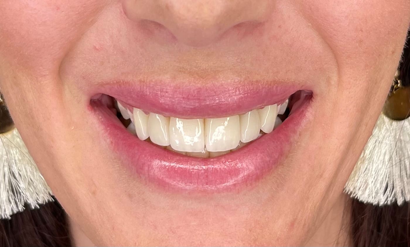 Smiling face of a woman