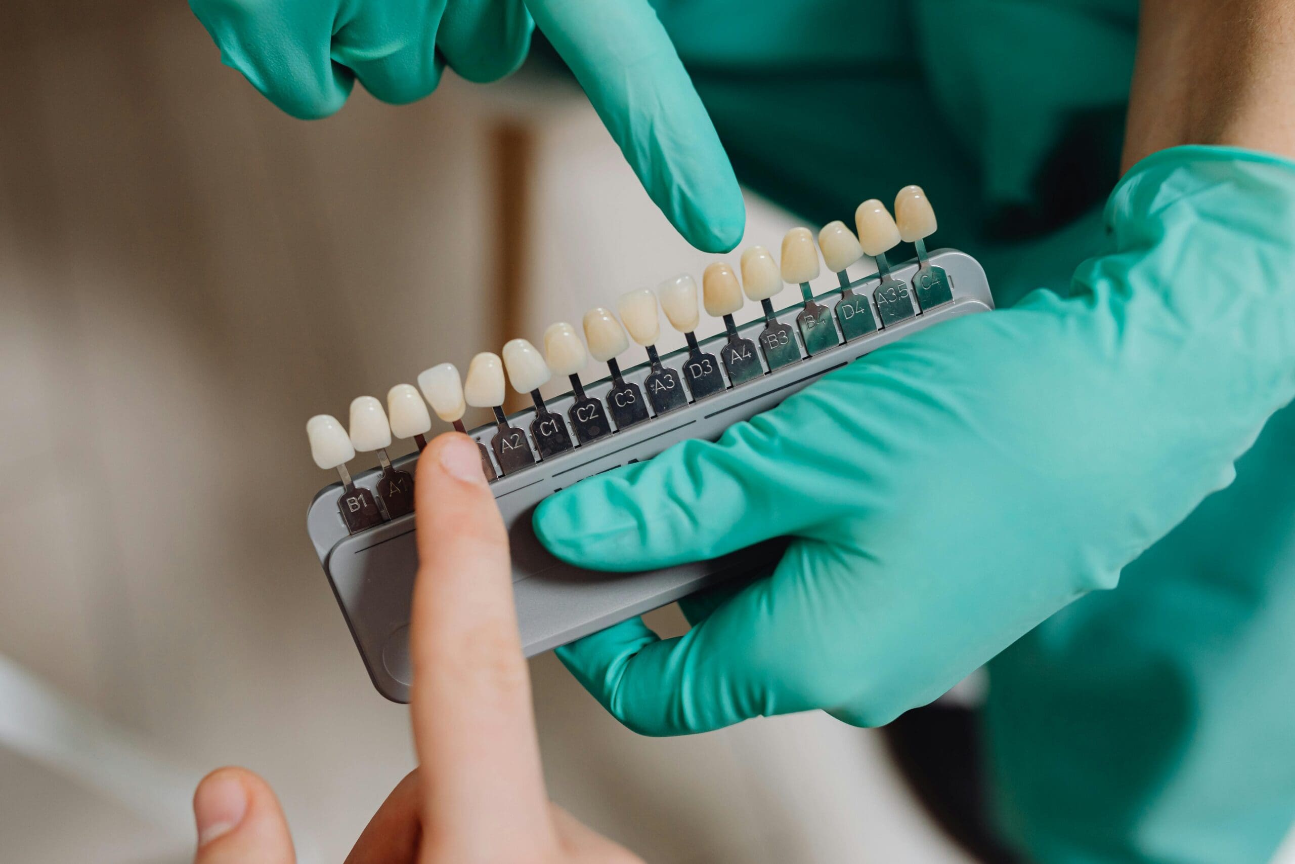 A patient selecting a shade from a tooth color guide during a whitening consultation.