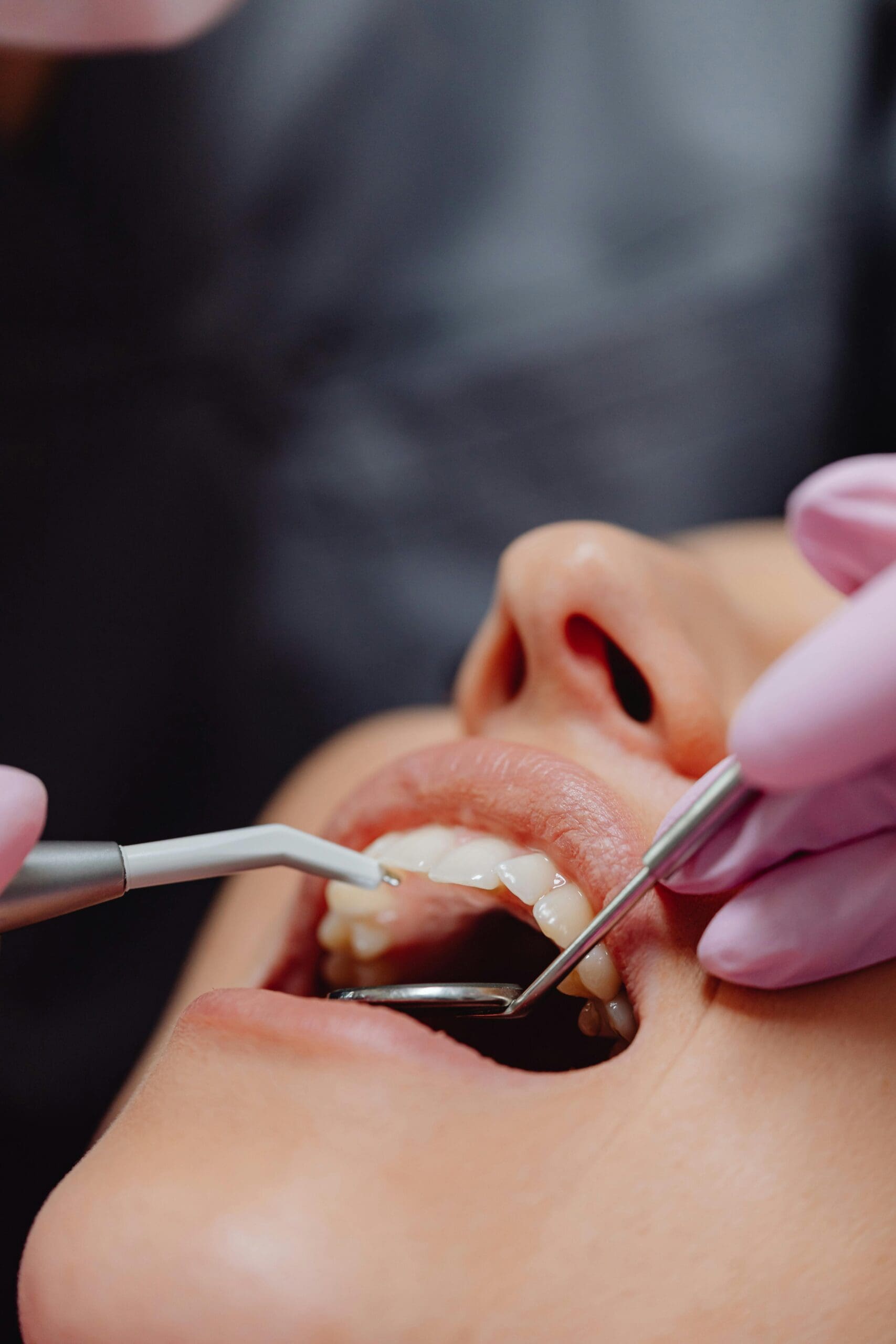 Close-up of a woman’s mouth being examined for cavities.