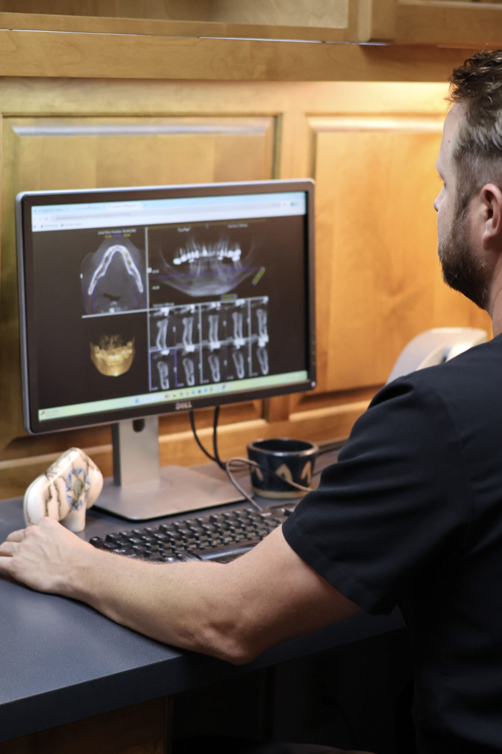 Dr. Stogsdill working on a computer to prepare a patient’s procedure for functional dentistry in Albuquerque.
