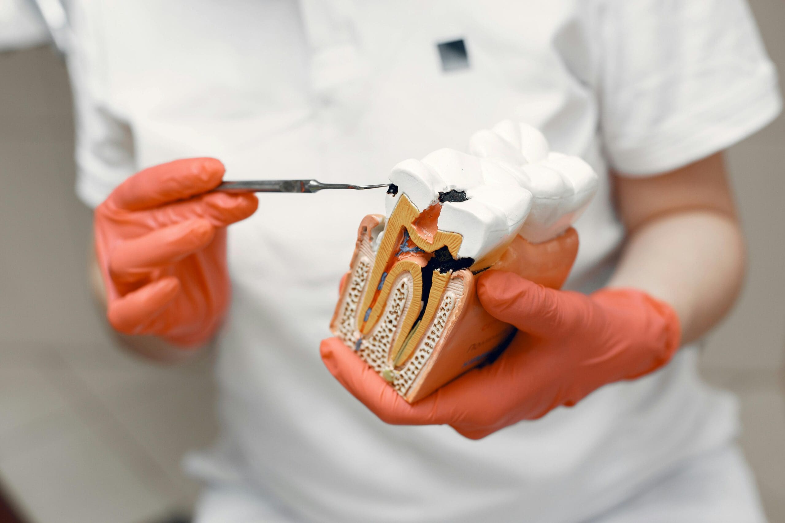 Dental professional explaining root canal treatment in Albuquerque with a tooth model.