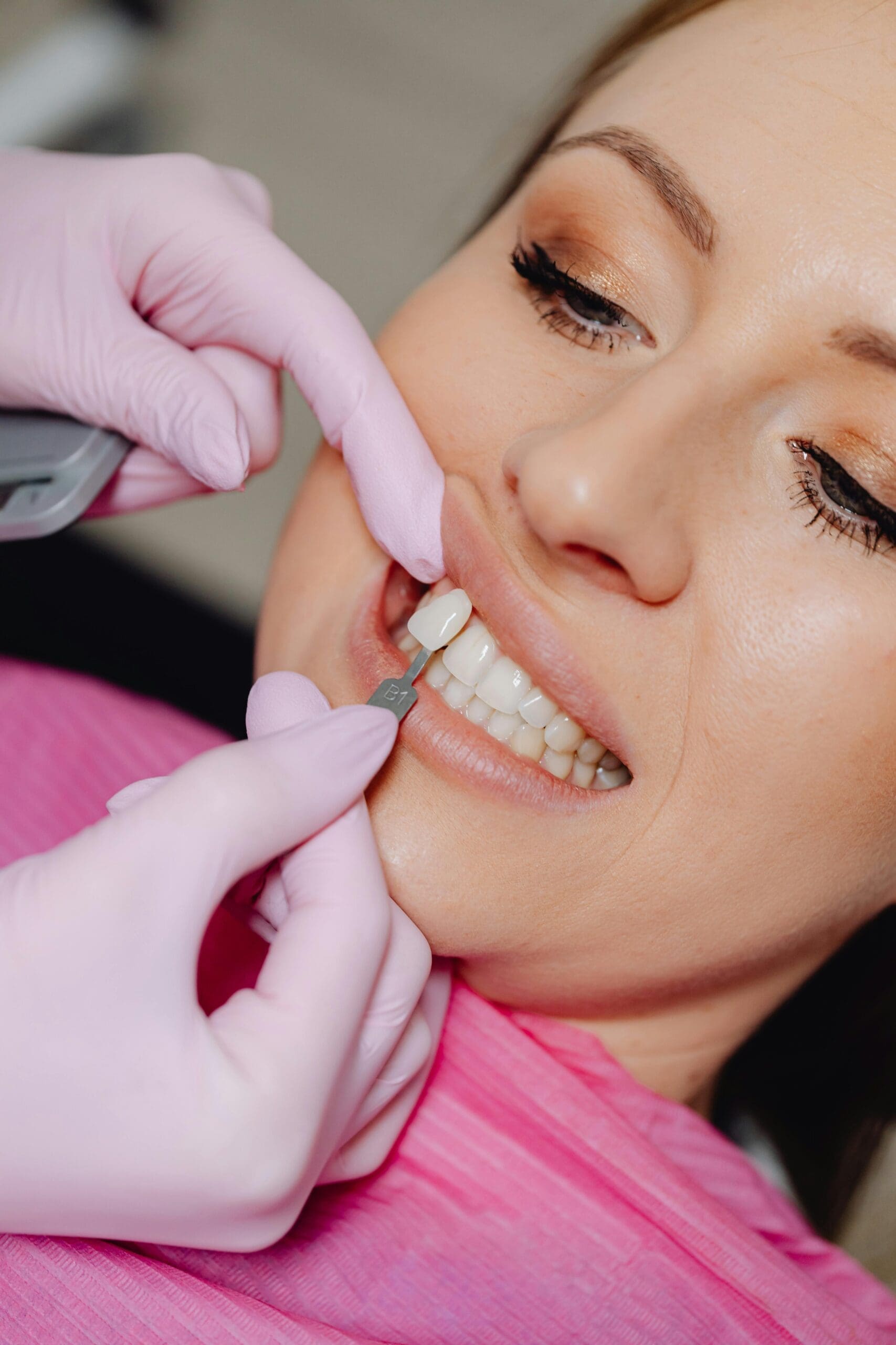 A woman getting veneers in a dental office.